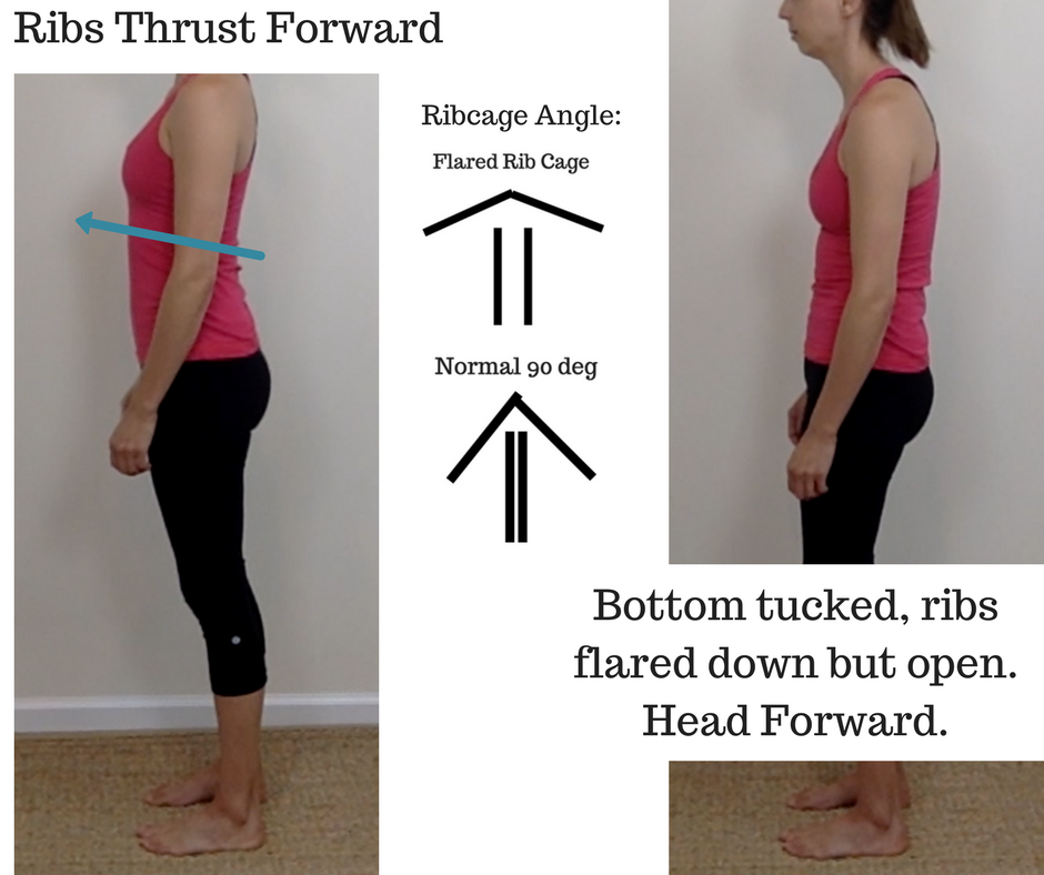 Rib Flare And Posture At Alicia Paige Blog