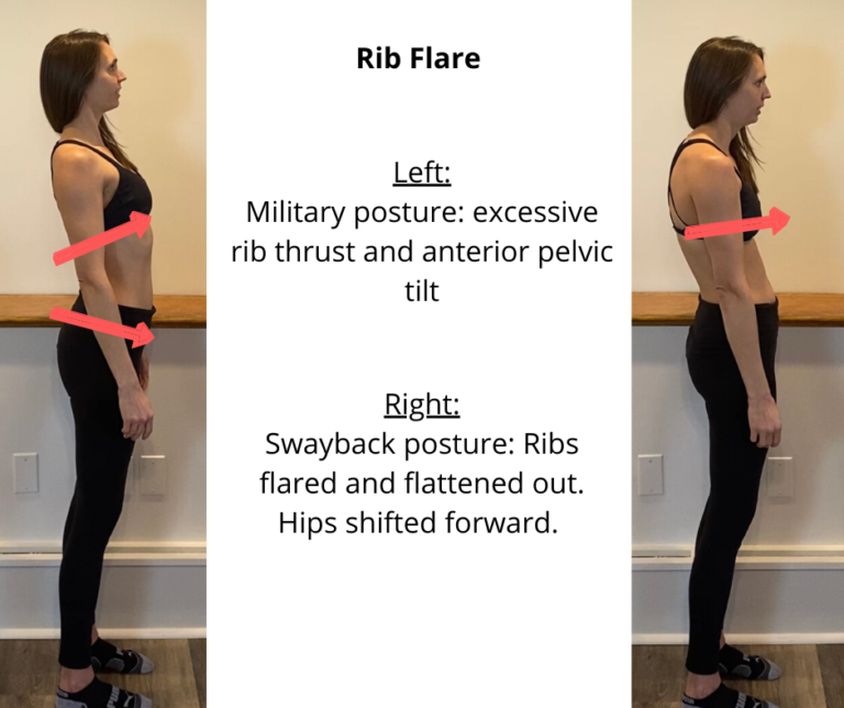 Rib Flare And Posture at Alicia Paige blog