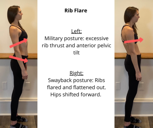 Rib flare is a common compensation pattern that could be setting