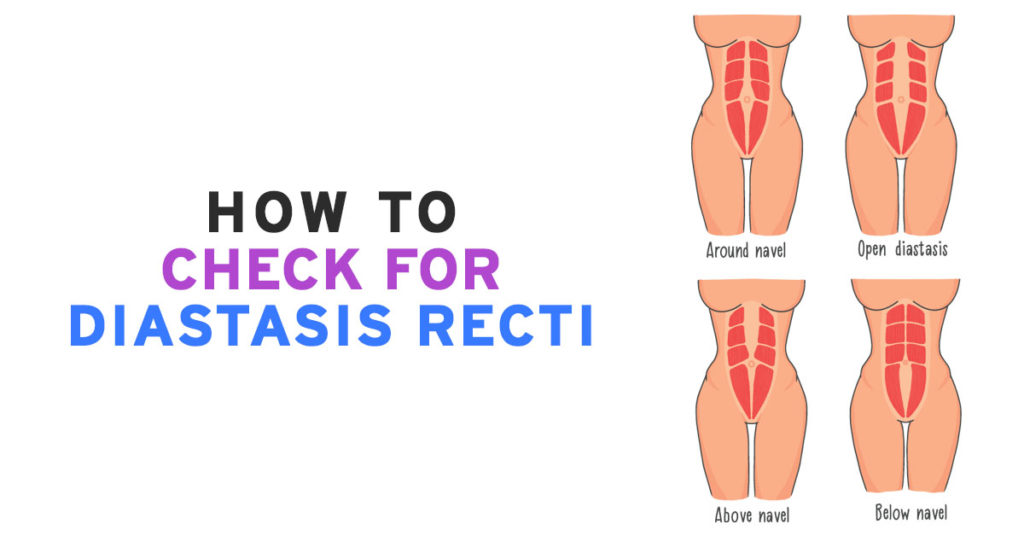 Is My Tummy Just Fat OR Do I Have Diastasis Recti? There's Only