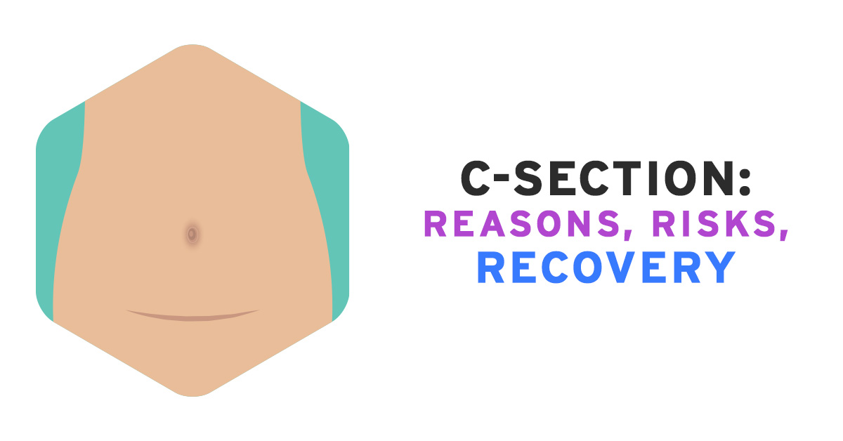 How To Massage A C-Section Scar - Reconnect Health Centre